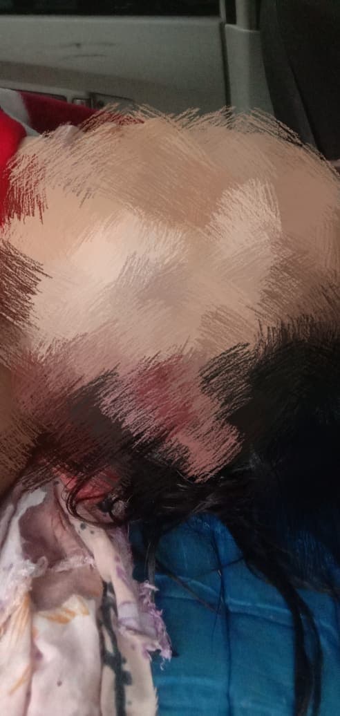 Jenazah Rina saat berada di ambulan.(IST)